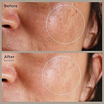 Nonapeptide-1