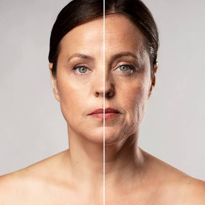 Anti Aging