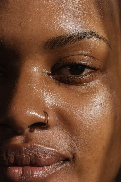 Oily skin